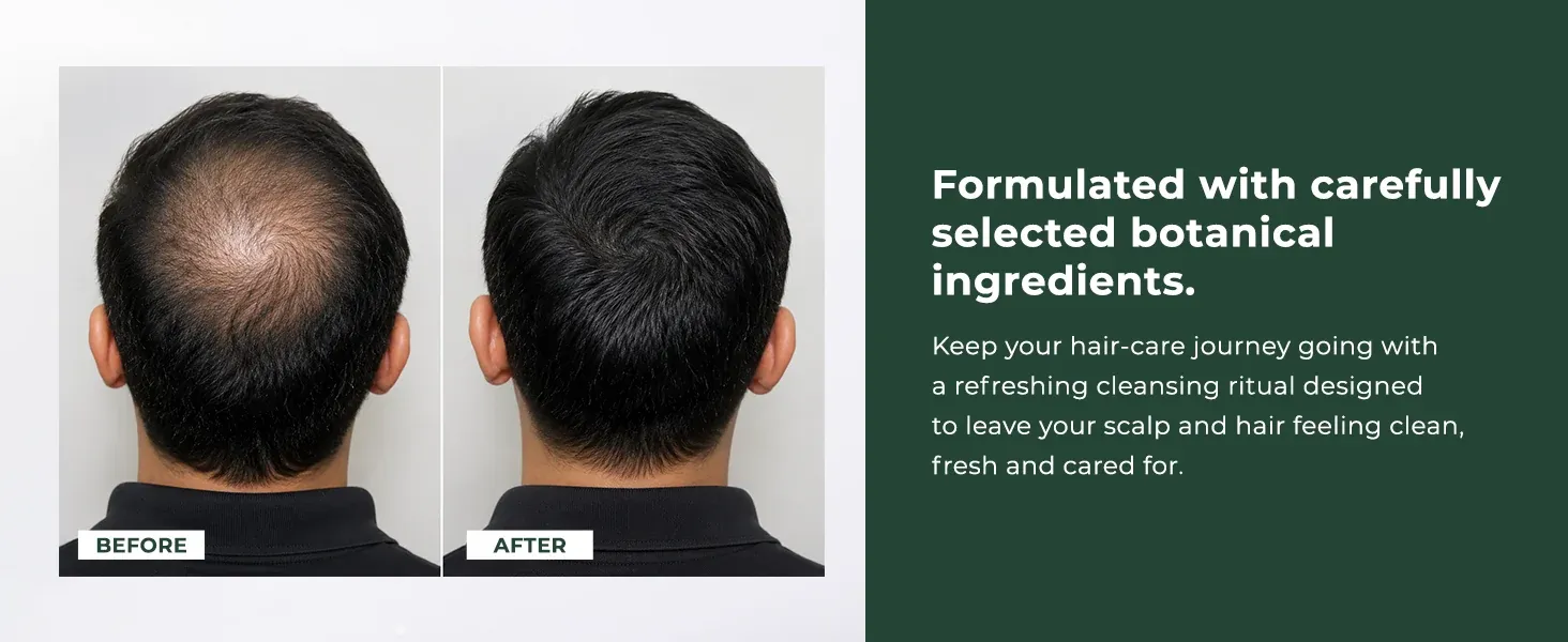 Before and after scalp comparison alongside the botanical ingredient statement Before and after scalp comparison alongside the botanical ingredient statement