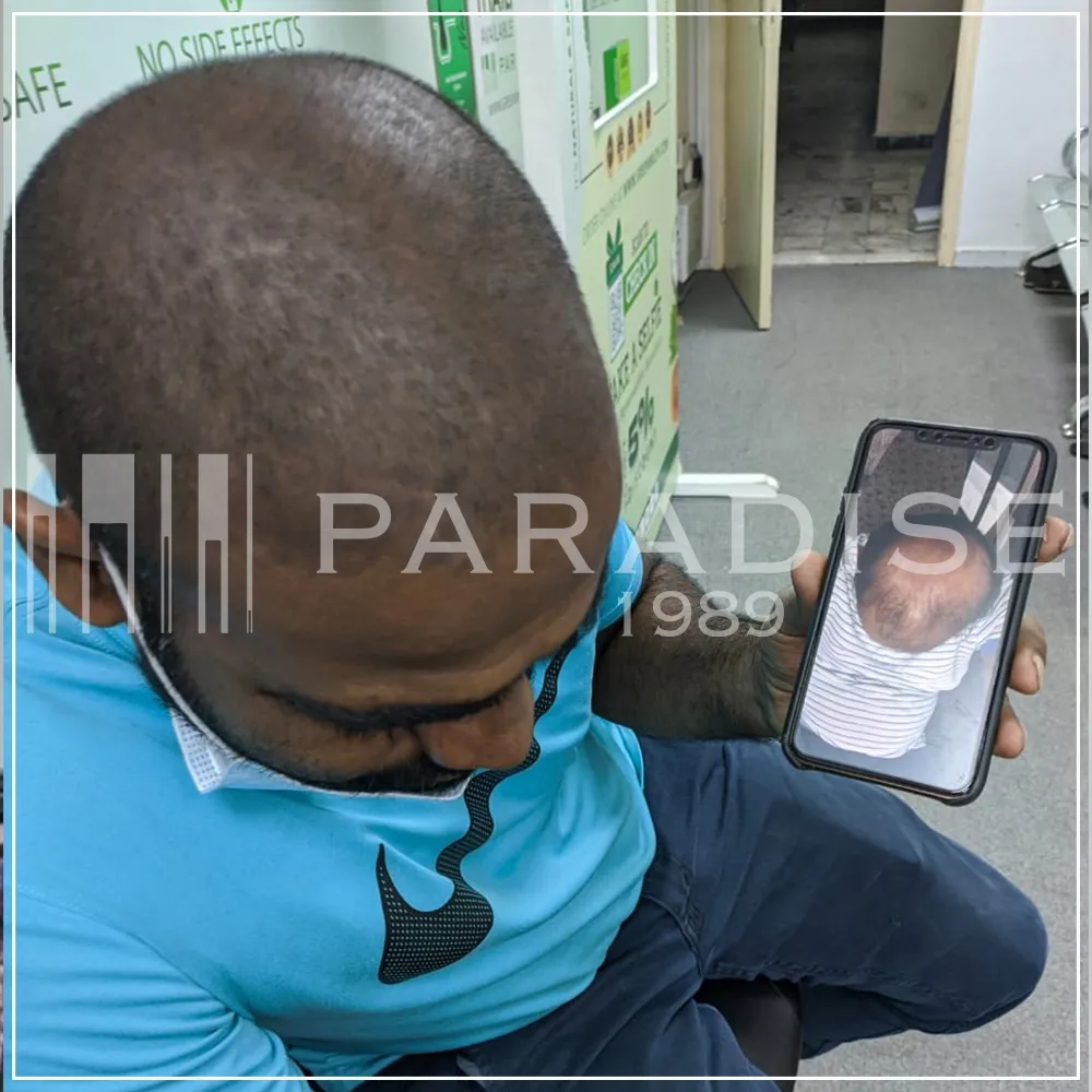 Verified review — Ahmed K. Verified customer photo review by Ahmed K. for Green Wealth Neo Hair products