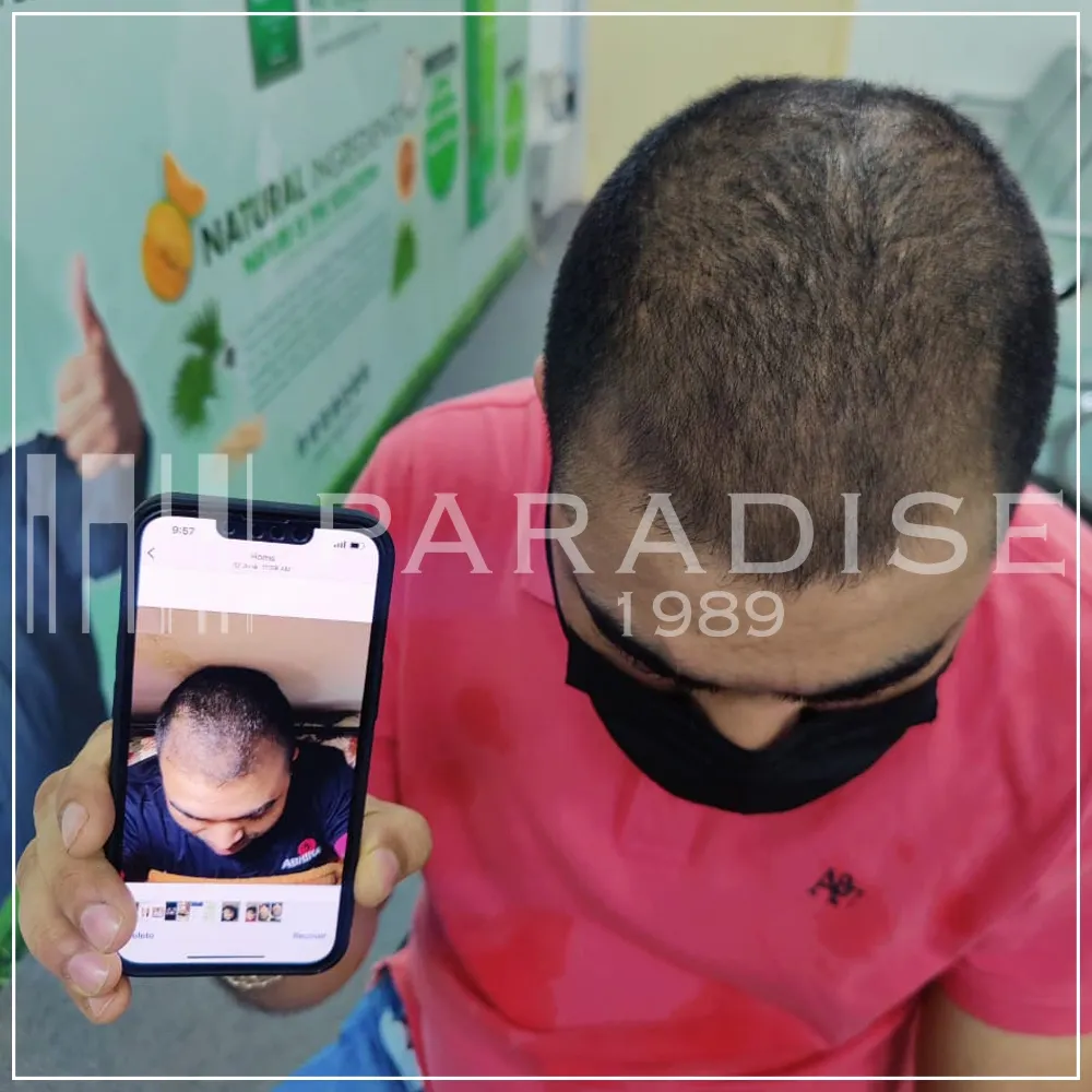 Verified customer photo review by Sanjay V. for Green Wealth Neo Hair products