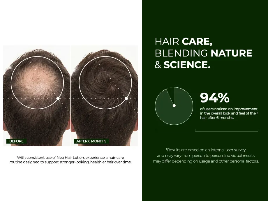 Neo Hair Lotion banner comparing the botanical formula with pharmaceutical alternatives Neo Hair Lotion banner comparing the botanical formula with pharmaceutical alternatives