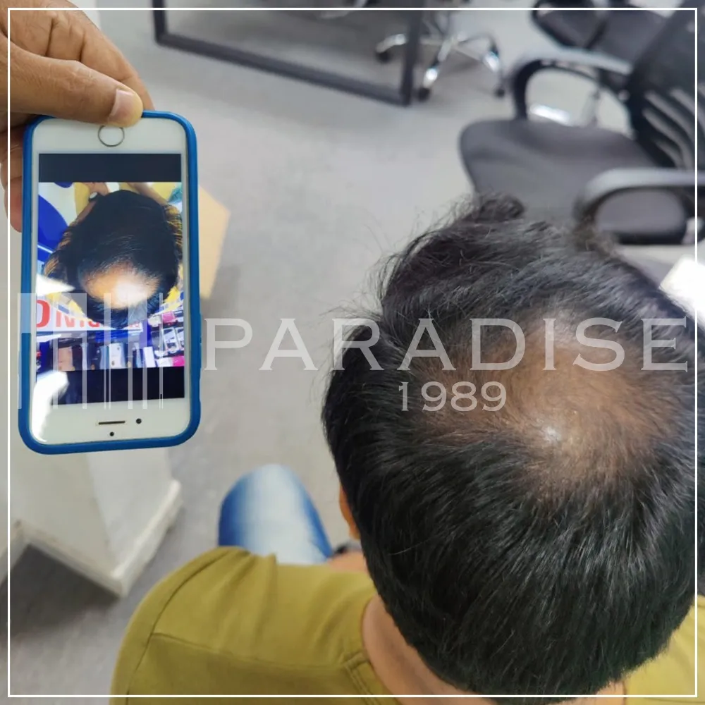 Verified customer photo review by Rajesh M. for Green Wealth Neo Hair products