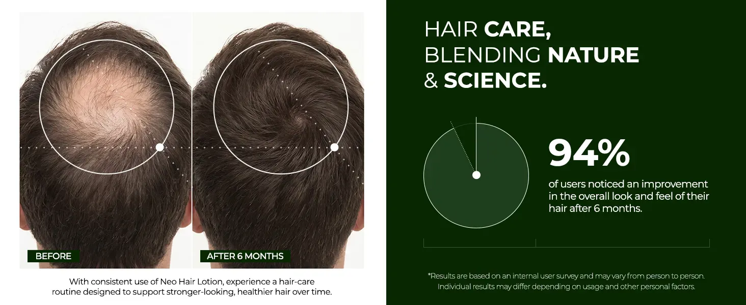 Neo Hair Lotion banner comparing the botanical formula with pharmaceutical alternatives Neo Hair Lotion banner comparing the botanical formula with pharmaceutical alternatives
