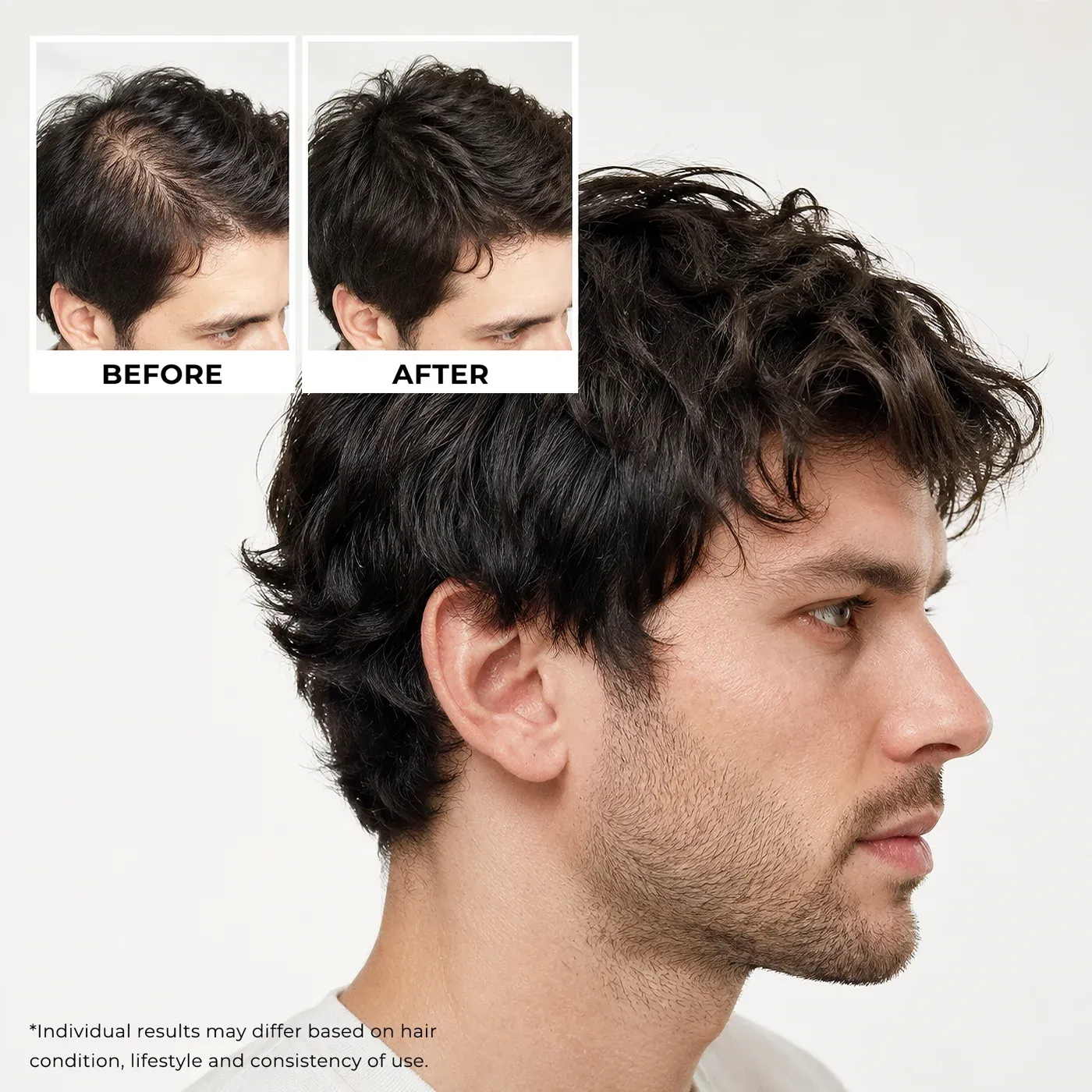 Neo Hair Shampoo — The formula Neo Hair Shampoo — The formula